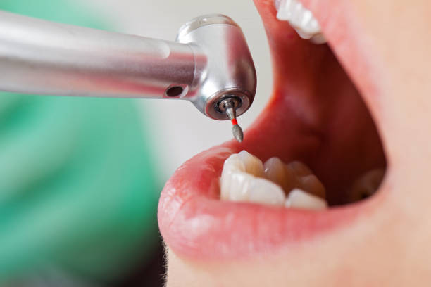 Best Broken or Cracked Tooth Emergency Dentist in Logan, IA